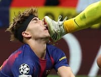 (VIDEO) Grozljiv prizor v ligi prvakov: Vratar je zvezdnika Barcelone zadel naravnost v obraz
