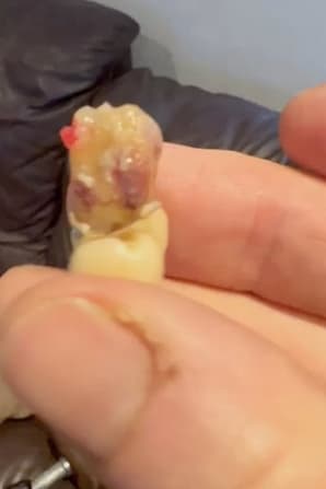 (FOTO) Zaradi nevzdržnih bolečin vzel stvari v svoje roke in šokiral splet