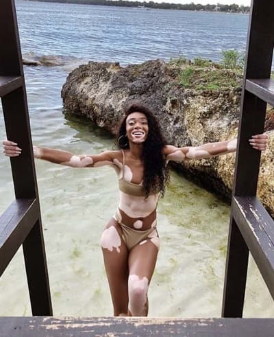 Winnie Harlow