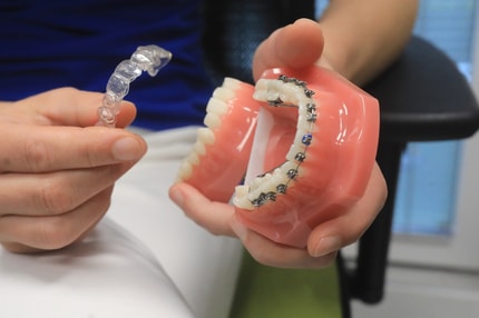 (FOTO) Otroci na zobni aparat čakajo tudi do dvanajst let. Kje so rešitve?