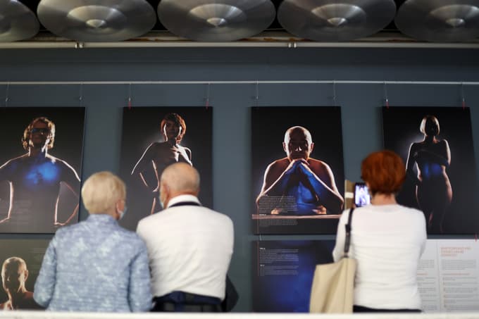 (FOTO) V UKC Ljubljana razstava o transplantacijah. Letos je darovalcev več