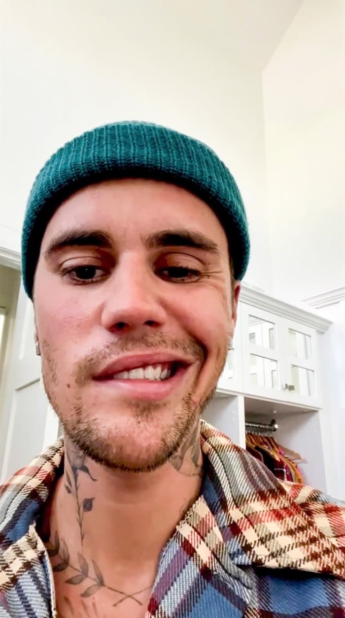 Redek sindrom je ohromil polovico njegovega obraza.