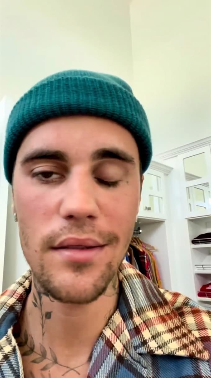 Utrujen in upadel: Kako zelo bolan je v resnici Justin Bieber? Ob odpovedi koncertov so oboževalci zaskrbljeni