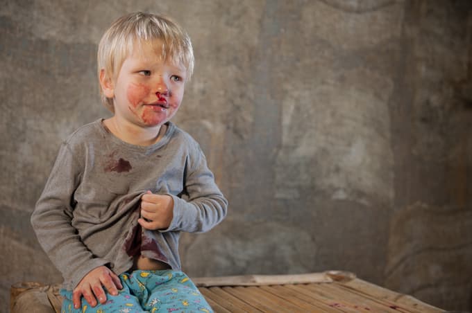 Danes otroci s hemofilijo potujejo in se ukvarjajo s športom