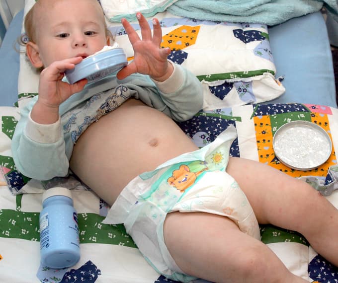 Milo, šampon, olje, krema: kaj je dobro za otroško kožo?