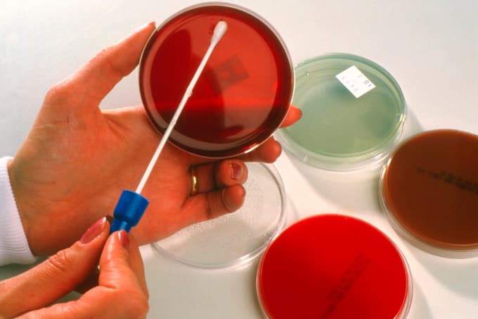 Huawei ostaja vodilni glede na število prijavljenih patentov pri Evropskem patentnem uradu