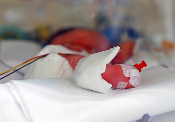 Za večino ljudi je RSV nedolžna okužba, najmanjšim dojenčkom pa lahko povzroči hude zdravstvene težave.