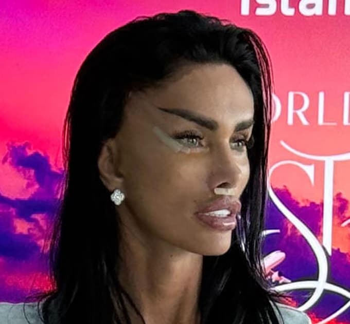 (FOTO) Katie Price šla znova pod nož. Ali bo s tem kdaj zaključila in kaj so ji lepotni kirurgi tokrat popravili?
