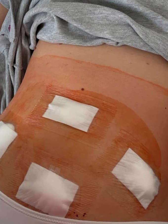 (FOTO) Slavna manekenka spregovorila o težki diagnozi: "Dolgo sem obilno krvavela in mislila, da je to normalno"