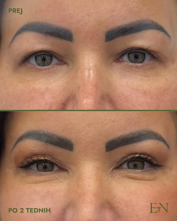 Estetski posegi je odgovornost, ne modna muha