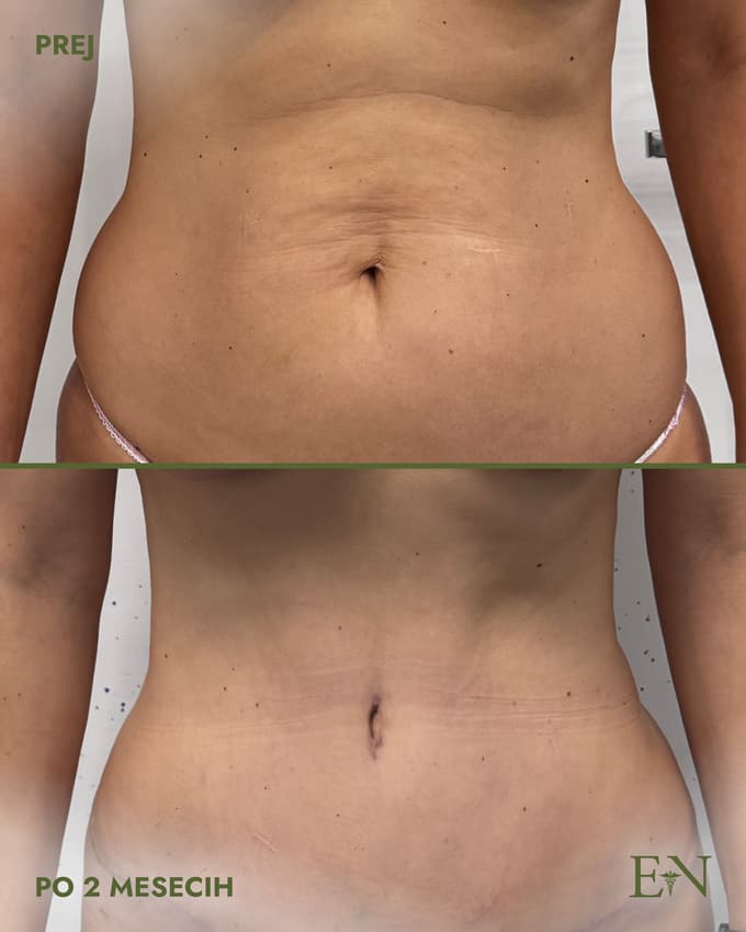 Estetski posegi je odgovornost, ne modna muha