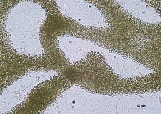 Cianobakterije pod mikroskopom
