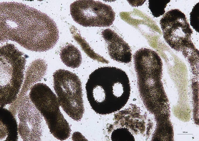 Cianobakterije pod mikroskopom