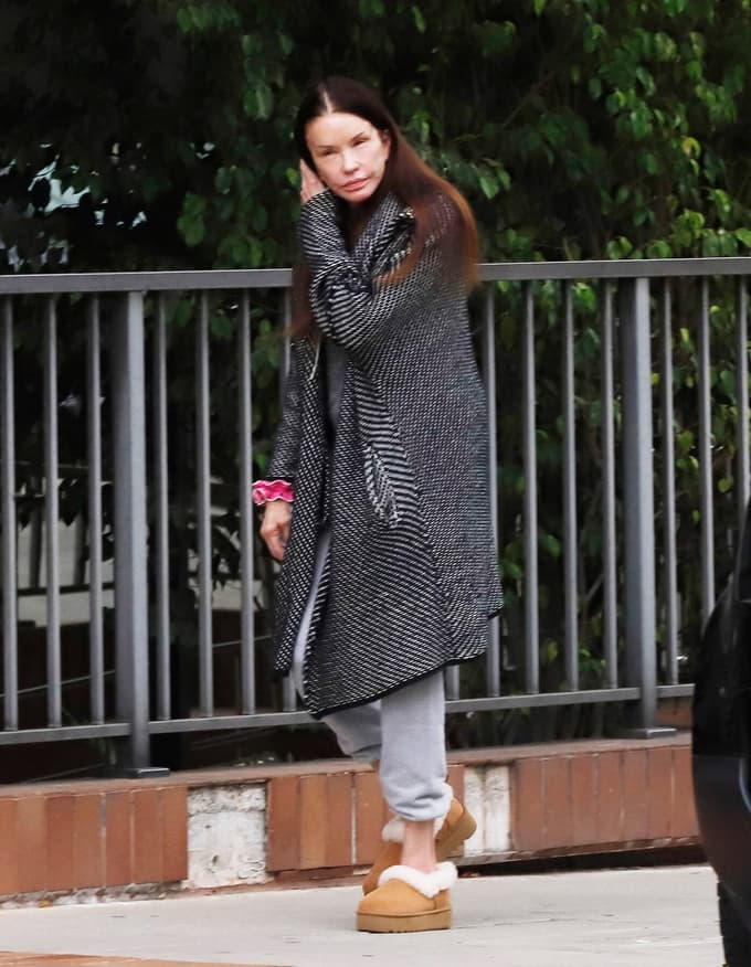 (FOTO) Bila je ena najlepših žensk na svetu, zdaj je zaradi estetskih operacij bankrotirala in je neprepoznavna