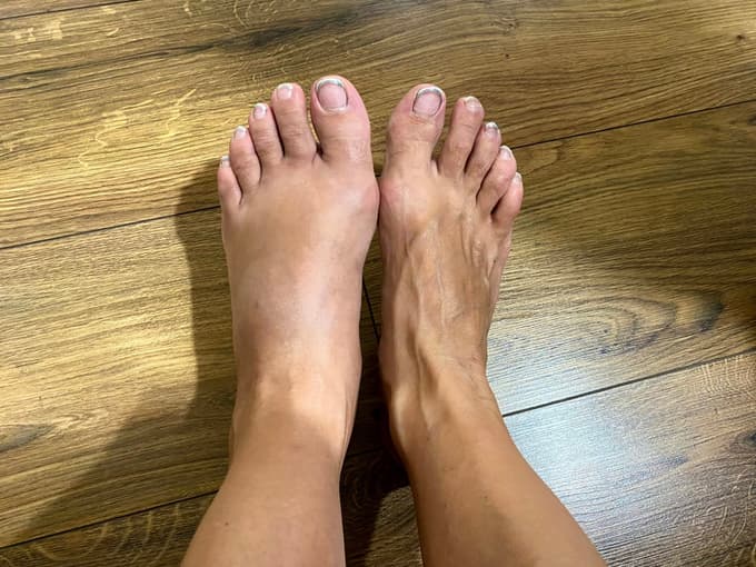 Ko obraz nenadoma oteče