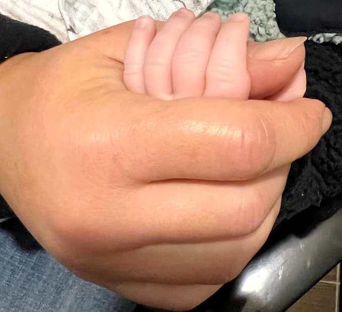 Ko obraz nenadoma oteče