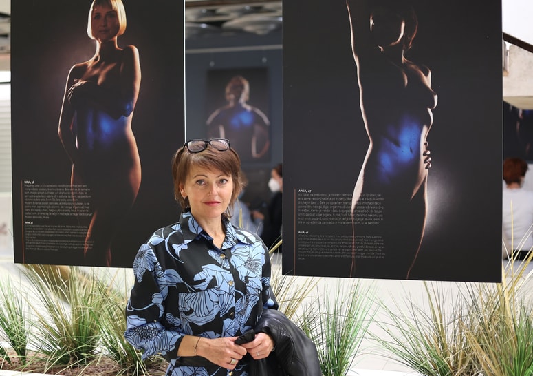 Anja Garbajs, ena pobudnic in modelov za razstavo z močnim sporočilom: Moja brazgotina, moje življenje. 