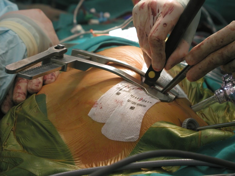 Glavna fotografija članka:Uspeh je, da družba razmišlja o darovanju