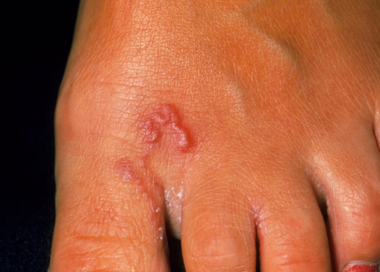 Pokvarjene počitnice