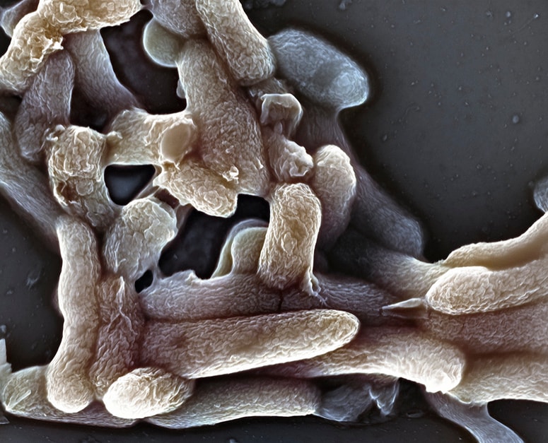 Salmoneloza je nalezljiva bolezen, katere povzročitelj se iz živali posredno ali neposredno prenaša na ljudi.