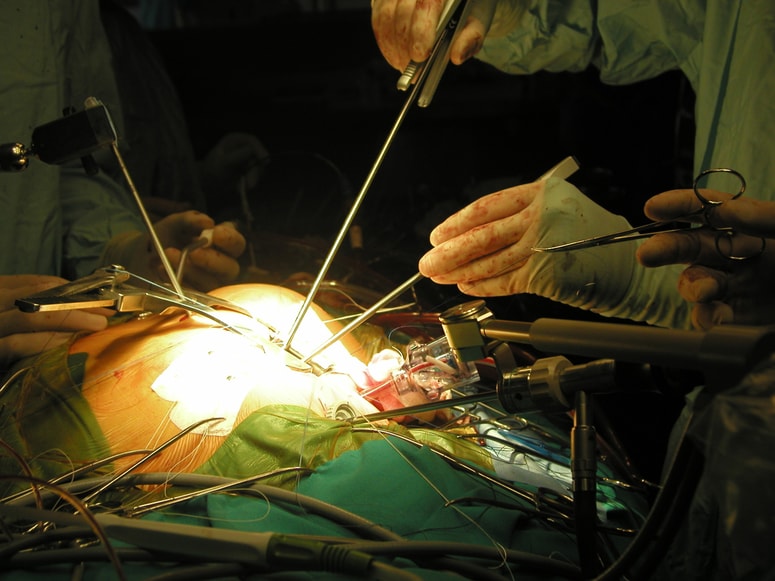 Glavna fotografija članka:(PISMO BRALCA) So trije centri za zdravljenje kardiovaskularnih bolezni v Sloveniji res premalo?