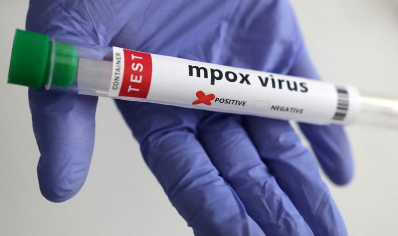 Virus mpox povzroča istoimensko nalezljivo bolezen, znano tudi kot opičje koze.