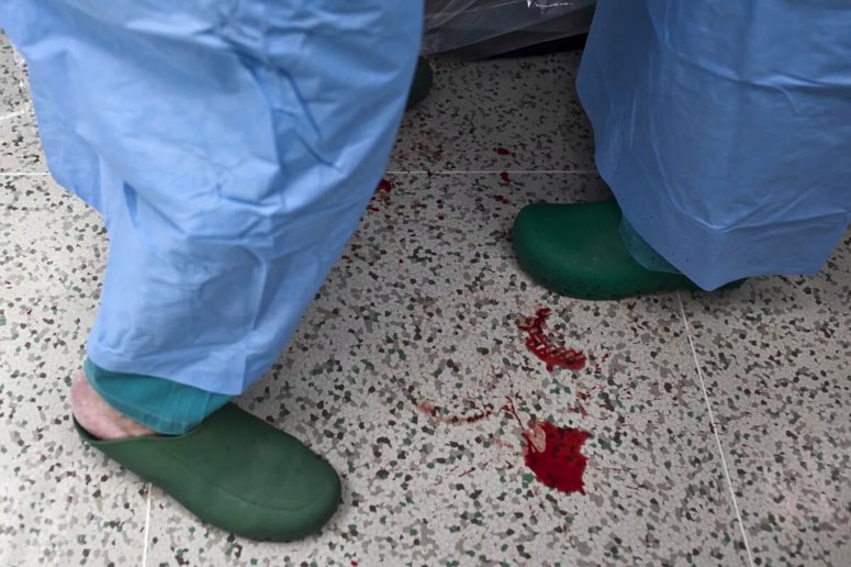 Tujek v telesu se je spremenil v fibrozno tvorbo, ki je sčasoma začela pritiskati na sosednje organe in pacientki povzročati težave.