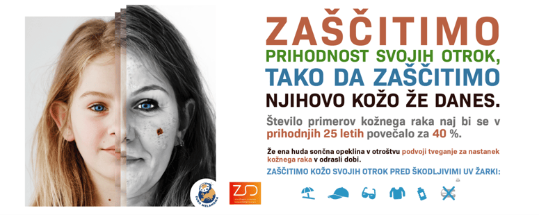 Glavna fotografija članka:Brezplačni pregledi kožnih znamenj