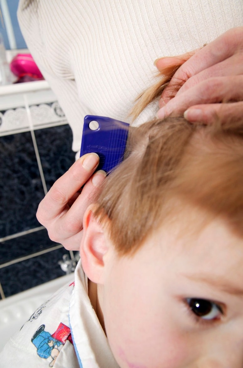 Za potrditev diagnoze morate natančno pregledati lase in lasišče, po možnosti pri močni svetlobi in z lupo.