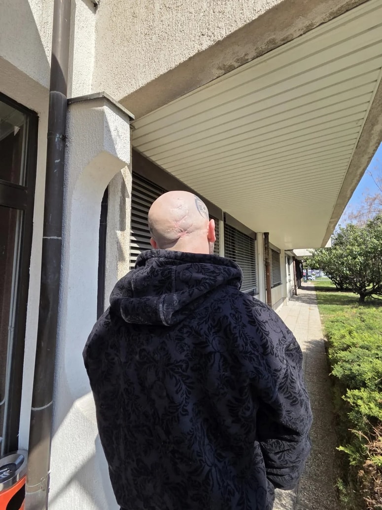 Po posledicah udarcev in operacij je zadnji del glave Patrika Zanka še vedno neobčutljiv, ne zaznava nobenih dražljajev. 