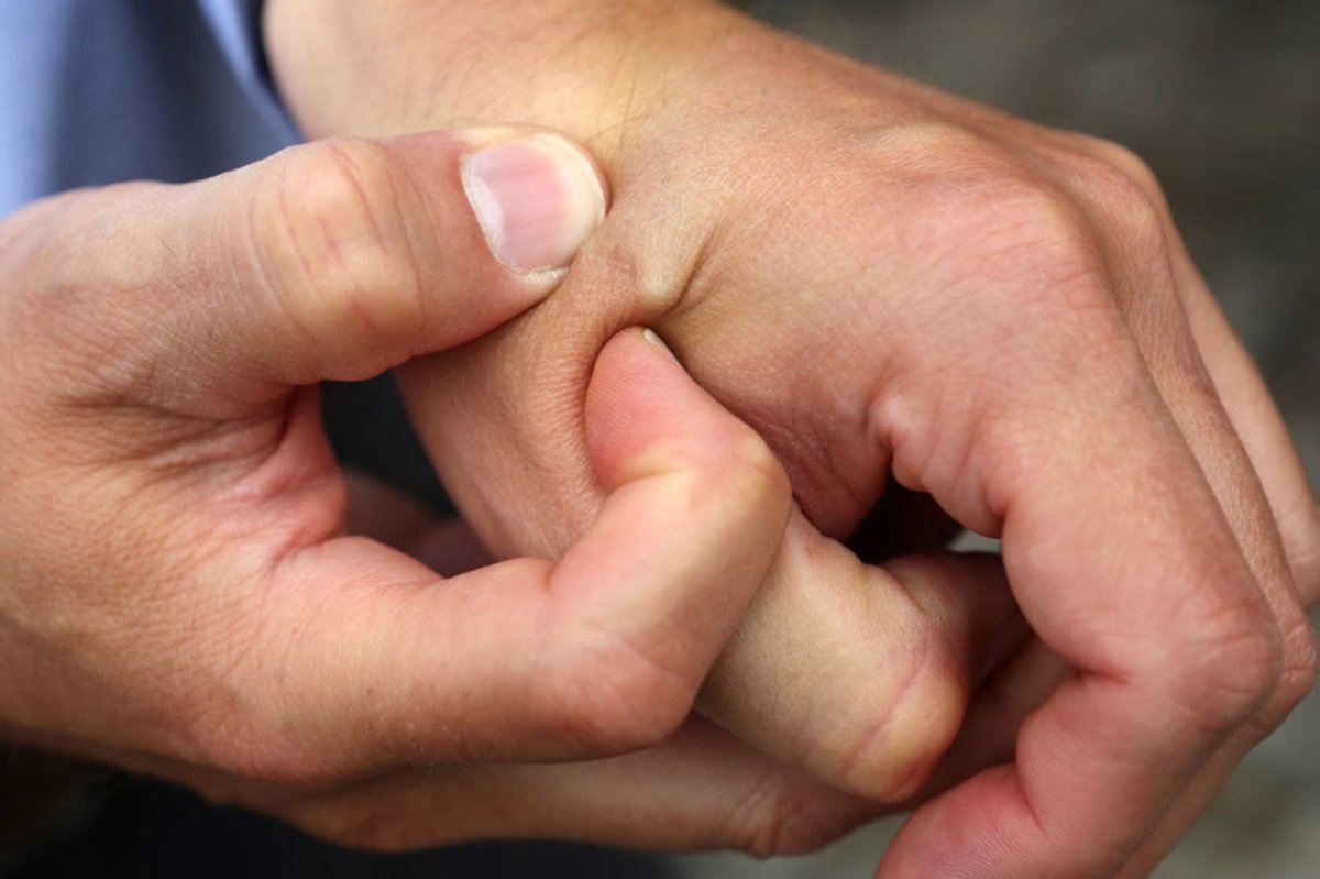 Implantacija čipa v telo: Tehnologija, ki zares zleze pod kožo
