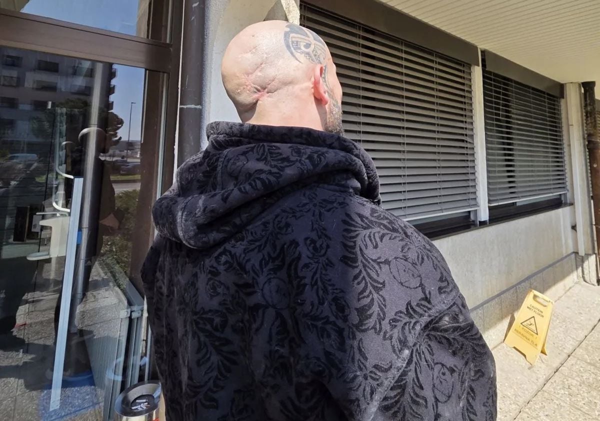 Patriku Zanku bodo na zatilju za vse življenje ostale brazgotine, kot spomin na udarce z ježevko. 